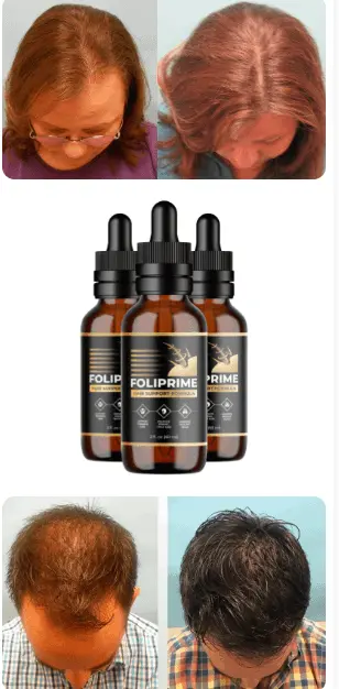 foliprime hair serum